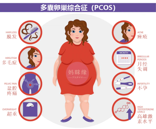 多囊卵巢综合征（Polycysticovarysyndrome, PCOS）症状