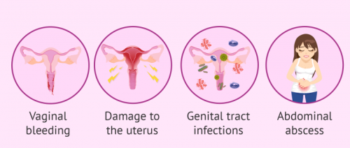 流产的风险和副作用 abortion risks and side effects_1