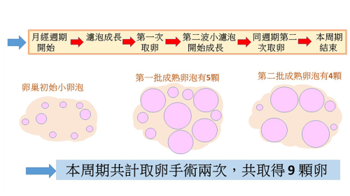 黄体期取卵 案例.png